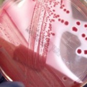 Przygotowanie do badań