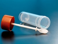 Kał – sposób pobrania, przechowywanie…